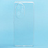 Чехол-накладка - Ultra Slim для "Honor 100 Pro" (прозрачный) (226777)